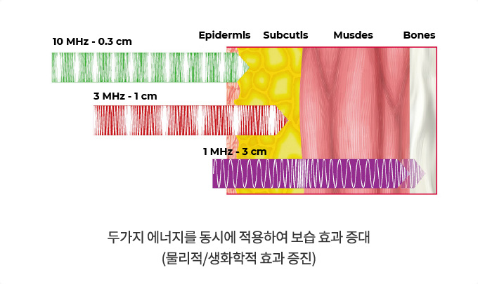 두가지 에너지를 동시에 적용하여 보습 효과 증대 (물리적/생화학적 효과 증진)